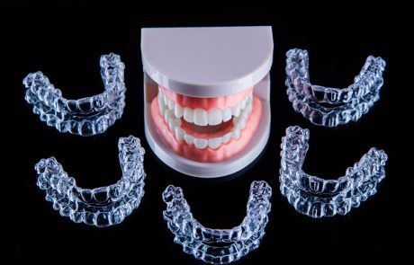 השתלת שיניים ביום אחד: פתרון מהיר לשיקום החיוך שלך